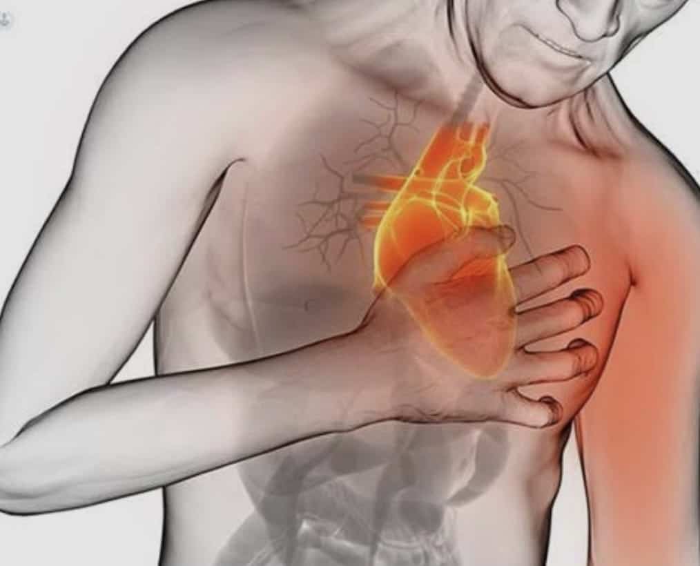 Infarto: ¿Por qué cada minuto cuenta y cómo reconocer síntomas inesperados?